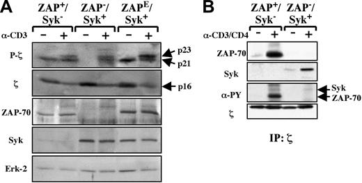 Figure 1. Defective basal and CD3-induced TCR-ζ chain phosphorylation in primary Syk+ T cells from a ZAP-70–deficient patient are restored following introduction of ZAP-70. CD4+ T cells from a healthy individual (ZAP+/Syk–), a ZAP-70–deficient patient (ZAP–/Syk+), and following introduction of ectopic ZAP-70 (ZAPE/Syk+)27,45 were either left unstimulated (–) or stimulated for 3′ with a cross-linked αCD3 mAb (+). (A) Phosphorylation of the TCR-ζ chain was monitored in whole cell lysates by the presence of the p21 and p23 TCR-ζ isoforms. Nonphosphorylated TCR-ζ migrates with a molecular weight of 16 kDa (p16). ZAP-70 and Syk levels in these whole cell lysates were assessed with ZAP-70– and Syk-specific Abs, and the relative amount of protein in each lane was determined by blotting for Erk2. Note that the ectopic ZAP-70 bears a terminal vesicular stomatitis virus-protein G epitope tag allowing endogenous and ectopic ZAP-70 proteins to be distinguished on the basis of their molecular weights. (B) TCR-ζ was immunoprecipitated from unstimulated (–) or αCD3/αCD4-stimulated (3′, +) control (ZAP+/Syk–), and patient (ZAP–/Syk+) CD4+ T cells. The levels of ζ-associated ZAP-70 and Syk molecules were determined by immunoblotting with αZAP-70 and αSyk Abs, and tyrosine phosphorylation of these proteins was monitored by immunoblotting with an α-phospho-tyrosine (PY) mAb. The amount of immunoprecipitated p16-ζ in each lane was monitored with an α-ζ mAb.
