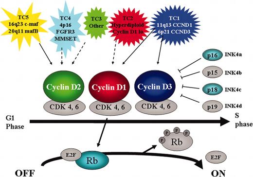 Figure 3. Critical role for cyclin D/Rb pathway in multiple myeloma. The 5 TC molecular subtypes of myeloma are characterized by either direct (solid arrow) or indirect (dashed arrow) dysregulation of a D cyclin. Cyclin D together with CDK4 and 6 is involved in G1-S cell cycle progression by phosphorylating and inactivating Rb. This reaction is inhibited by the CDK inhibitors INK4a-d. In addition to cyclin D, other members that are targeted by genetic mutation in MM are highlighted (p16 by methylation, p18 by small homozygous deletions, and Rb by monoallelelic deletion).