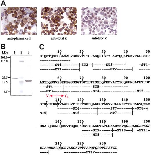 Figure 1. Immunocytochemical analyses of plasma cells from the patient with NSM and chemical characterization of the nonsecreted κ light chains. (A) Reactivity of bone marrow–derived plasma cells. The primary reagents included a murine antiplasma cell mAb and those specific for free or bound human κ light chains. Microscopic analyses were performed using a Leitz DMRB microscope (Vashaw Scientific, Norcross, GA) and objectives that included Leica HC PL Fluotar 40× and 10× lenses. The digital photographs were taken with a SPOT RT Model 2.2.0 camera (Diagnostic Instruments, Sterling Heights, MI) using SPOT RT software, version 3.0. Original magnification, × 400. (B) Coomassie blue-stained SDS/PAGE gel of protein contained in the plasma cell lysates (lane 1), molecular mass standards (lane 2), and a κ1 Bence Jones protein isolated from the urine of a patient with MM (lane 3). (C) Primary structure of the κ1 light chain isolated from plasma cell lysates. The N-terminal amino acid sequence was established directly and the remainder from tryptic peptides subjected to Edman degradation (ST) and mass spectrometry (MT). The residues in parentheses were deduced from cDNA cloned from the patient's plasma cells. The junction between the VL and CL domains is as designated and the anomalous residues after position 187 are italicized.