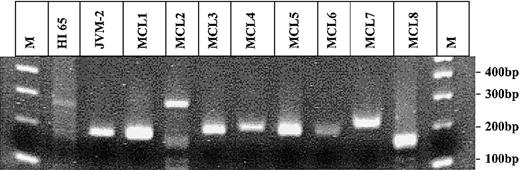 Figure 1. Agarose-gel electrophoresis of all t(11;14) PCR fragments amplified in this study and ever in our laboratory. Gel electrophoresis of all t(11;14) fragments amplified by PCR. Lanes 1 and 12: 100 bp molecular weight marker (M); lane 2: HI 65; lane 3: JVM-2; lanes 4-11: MCL1-8.