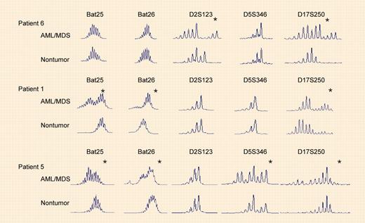 Microsatellite instability in AML/MDS from recipients of organ transplants. See the complete figure in the article beginning on page 822.