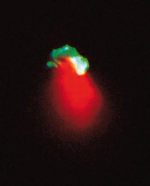 SDF has fibroblastoid morphology. See the complete figure in the article beginning on page 675.