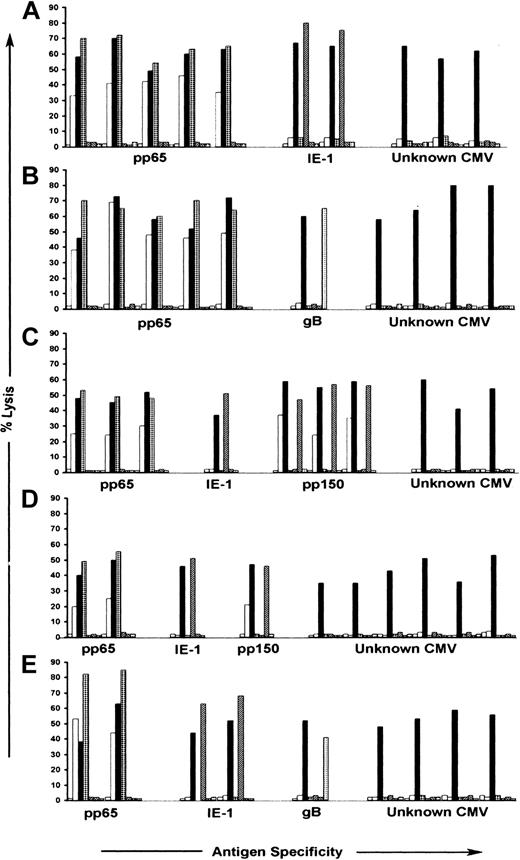 Figure 3. Antigen recognition by CMV-specific CD8+ CTL clones isolated following stimulation with autologous fibroblasts infected with RV798. CMV-specific CD8+ CTL clones were tested for recognition of autologous fibroblasts either mock-infected (), infected with AD169 (□), or infected with RV798 (▪), in a chromium release assay. Autologous LCL infected with Vac/pp65 (▦), Vac/IE-1 (▨), Vac/pp150 (▧), and Vac/gB (▦) were used as target cells in the same assay to confirm specificity. Data are shown for 10 representative CTL clones from each of the 5 donors in proportions selected based on the relative frequency of antigen specificities shown in Table 2. The data are shown at an E/T ratio of 10:1. (A) Donor 1; (B) donor 2; (C) donor 3; (D) donor 5; (E) donor 7.