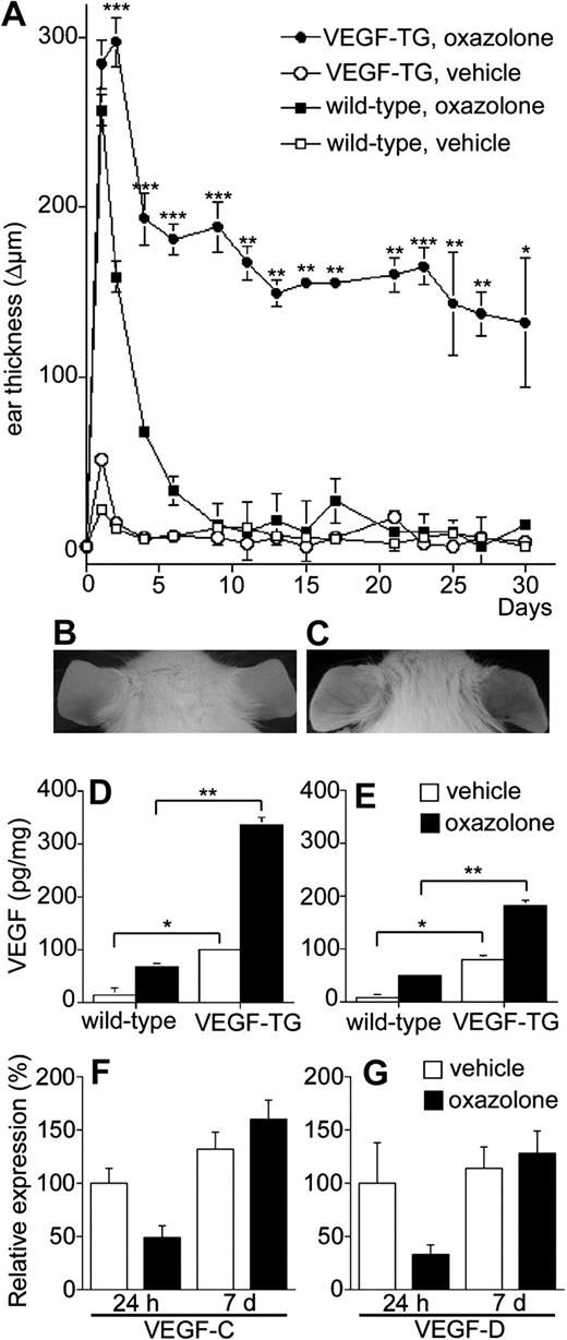 Figure 1. Increased and prolonged ear swelling in DTH reactions elicited in VEGF-A transgenic mice. DTH reactions were induced in the ear skin of VEGF-A transgenic and in wild-type mice using oxazolone (A). Ear swelling is expressed as the increase (Δ) over the original ear thickness in μm. Challenged ears in VEGF-A transgenic mice (•) and wild-type mice (▪) showed comparable swelling 24 hours after challenge with oxazolone. Whereas in wild-type mice the swelling reached background levels within 7 days, it was significantly increased and prolonged in VEGF-A transgenic mice. ○ indicates vehicle-treated VEGF-A transgenic mice; □, vehicle-treated wild-type mice. Data are expressed as mean plus or minus standard deviation (SD; n = 5 per condition and time point). After 30 days, inflammation had disappeared in wild-type mice (B). In VEGF-A transgenic mice, the challenged right ears remained erythematous, thickened, and scaly with pronounced vascularization (C). VEGF-A ELISA revealed higher protein concentrations in the noninflamed ears of VEGF-A transgenic mice at 24 hours (D) and 7 days (E) than in wild-type controls. At both time points, VEGF-A levels were increased in the inflamed skin of wild-type mice and were even further elevated in transgenic mice. Data are expressed as mean plus or minus standard error of the mean (SEM; n = 3 per condition and time point). *P < .05; **P < .01; ***P < .001. Taqman quantitative real-time RT-PCR revealed that the mRNA expression levels of the lymphangiogenesis factors VEGF-C and VEGF-D were not up-regulated in the inflamed skin of VEGF-A transgenic mice, as compared with vehicle-treated skin (F,G). Data are expressed as mean plus or minus SD (n = 3 per condition and time point).