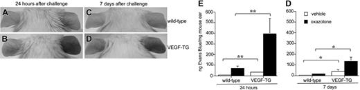 Figure 3. Enhanced vascular leakage in the inflamed skin of VEGF-A transgenic mice. Induction of DTH reactions in the right ears of wild-type mice resulted in moderately increased vascular leakage, as visualized by the extravasation of Evans blue dye (A) which normalized within 7 days (C). Highly increased vascular permeability in the right ear of a VEGF-A transgenic mouse 24 hours after antigen challenge (B) and persistent though reduced Evans blue dye extravasation 7 days thereafter (D). Quantitative analysis of Evans blue dye deposition revealed enhanced vascular leakage in VEGF-A transgenic mice 24 hours (E) and 7 days (F) after elicitation of DTH reactions. Data are expressed as mean plus or minus SEM. *P < .05, **P < .01.