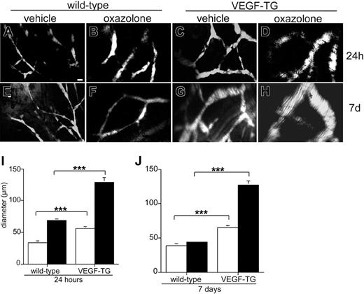 Figure 5. Transgenic VEGF-A induces enlargement of lymphatic vessels in vivo. Fluorescently labeled dextran was injected into the ear skin of VEGF-A transgenic (VEGF-TG) and wild-type mice. In wild-type mice, lymphatic vessels were relatively small in vehicle-treated skin (A) and were dilated within 24 hours after initiation of DTH reactions (B). In VEGF-A transgenic mice, lymphatic vessels were larger than wild-type vessels under noninflamed conditions (C) and were further enlarged 24 hours after antigen challenge (D). In wild-type mice, lymphatic vessels returned to their normal size within 7 days after challenge (E-F). This is in contrast to VEGF-A transgenic mice, in which the lymphatic vessels in the inflamed skin remained dramatically enlarged (H) compared with vehicle-treated tissue (G) for more than 7 days. Differences in vessel diameters in vivo were calculated 24 hours (I) and 7 days (J) after antigen challenge and are expressed as mean plus or minus SEM (n = 90 regions of interest per genotype and time point). ***P < .001. Scale bar: 100 μm.