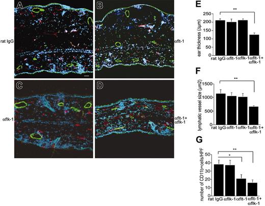 Figure 7. Systemic blockade of VEGFR-1/flt-1 and VEGFR-2/flk-1 inhibits skin inflammation and lymphatic enlargement. Differential immunofluorescence stains for CD31 (red) and LYVE-1 (green) in mouse ear skin 24 hours after antigen challenge. Edema formation and enlargement of lymphatic vessels was not significantly influenced by systemic application of rat control IgG (A), antibodies against VEGFR-1/flt-1 (B), or antibodies against VEGFR-2/flk-1 (C). Scale bar, 100 μm. In mice that were treated with a combination of antibodies against VEGFR-1/flt-1 and VEGFR-2/flk-1, edema formation and enlargement of lymphatic vessels was significantly reduced (D). Ear swelling is expressed as the increase over the original ear thickness in micrometers (E). Computer-assisted morphometric analysis of LYVE-1–stained vessels 24 hours after challenge revealed a significant reduction in lymphatic vessel size in mice that were treated with antibodies against VEGFR-1/flt-1 and VEGFR-2/flk-1 (F). Significantly reduced numbers of CD11b+ macrophages in the oxazolone-challenged ears after systemic blockade of VEGFR-1/flt-1 (G). Data are expressed as mean plus or minus SEM (n = 3). *P < .01; **P < .001.
