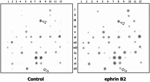 Figure 2. Comparison of the transcriptions of 141 angiogenesis-associated genes between HUAECs with and without treatment of ephrinB2 by cDNA microarray. The cDNA microarray membrane contains 141 gene clones. A total of 2.5 μg mRNA from HUAECs treated with 200 ng/mL preclustered ephrinB2 or 2 μg/mL clustering Ab alone for 4 hours was labeled with biotin-16–deoxyuridine triphosphate (biotin-16-dUTP) by reverse transcription and hybridized to the cDNA membrane, followed by color development. The genes that appeared to be upregulated are listed in Table 1. The arrowhead indicates β-actin (array no. C08), and the arrow indicates syntenin (array no. L08).