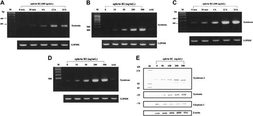 Figure 3. The temporal and dose effects of ephrinB2 on expressions of syntenin and syndecan-1 in HUAECs by RT-PCR and Western blot. (A-D) To confirm the results of differentially expressed genes obtained by the cDNA microarray technique, each candidate gene was further analyzed with RT-PCR to test dose dependence and time dependence. Syntenin and syndecan-1 were the only 2 genes up-regulated in dose- and time-dependent manners. Neutralizing antibody (10 μg/mL) against the N-terminal of EphB4 receptor suppressed the up-regulation of syntenin and syndecan-1 by ephrinB2 (B,D). G3PDH was used as an internal control. The sizes of the PCR products were 388, 416, and 983 bp for syntenin, syndecan-1, and G3PDH, respectively. (E) Western blot of syntenin and syndecan-1 in HUAECs treated with different doses of ephrinB2. HUAECs were treated with preclustered ephrinB2 (0 to 500 ng/mL) for 24 hours. The cell lysates were then collected and analyzed with Western blot for syntenin and syndecan-1. The molecular weight for syndecan-1 is about 110 kDa for the major band and about 90 kDa for the minor band. The detected band for syntenin is about 33 kDa. Glypican-1 (another cell membrane proteoglycan on endothelial cells) and β-actin were used as controls.