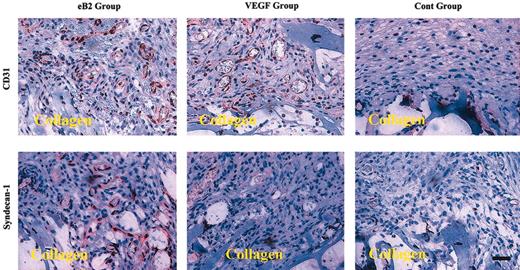 Figure 6. EphrinB2 enhances angiogenesis and expression of syndecan-1 in the murine wound healing model. Collagen sponges containing either 2 μg preclustered ephrinB2 or 0.2 μg VEGF or clustering Ab alone (control) were implanted subcutaneously in mice for 7 days (n = 5 for each group). The collagen sponges with surrounding tissue were excised and embedded in paraffin and then processed for immunostaining of CD31 and syndecan-1. The positive reaction appeared red from peroxidase-AEC. eB2 indicates ephrinB2; cont, control. Original magnification × 100. Scale bar equals 75 μm.