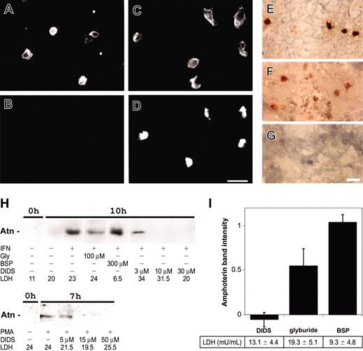 Figure 2. Secretion of amphoterin from mononuclear cells. (A-D) Freshly isolated peripheral blood leukocytes were double-immunostained in suspension (A-B) and after adhesion and culture on coverslips for 18 hours in the presence of 10% autologous serum (C-D). Staining for CD14 is shown in panels A and C and for amphoterin in panels B and D. Cells were fixed with 2% paraformaldehyde for 15 minutes and double-stained with anti-CD14 and TRITC-conjugated antimouse immunoglobulins followed by anti-recAtn and FITC-conjugated antichicken immunoglobulins. (E-G) Embolectomy sample taken within 24 hours of the onset of symptoms for lower-limb arterial occlusion was snap-frozen in liquid nitrogen. Frozen sections were fixed with cold acetone, incubated with anti-recAtn (E-F) or nonspecific chicken IgY (G), and detected with peroxidase-labeled antichicken IgY. Scale bar 20 μm (A-G). (H) Secretion of amphoterin from RAW 264.7 cells is induced by IFN-γ and PMA and inhibited with ABC-1 inhibitors DIDS and glyburide. Cells were treated with 20 ng/mL IFN-γ or 10 nM PMA, and medium samples (0, 7, or 10 hours) were collected. Medium (1.5 mL) was concentrated to 15 L and analyzed in anti-recAtn Western blotting. Amphoterin was detected from activated cell culture medium after 7 or 10 hours of culture. Secretion was dose dependently inhibited with DIDS and to a lower extent with glyburide. BSP did not inhibit secretion. Medium samples were analyzed for activity (in mU/mL) of LDH by enzyme activity measurement. The results shown are from a representative experiment of at least 3 experiments. IFN indicates IFN-γ. (I) Optical density (OD) of the amphoterin band in Western blotting of IFN-γ activated (7 hours) cell culture supernatants, and lactate dehydrogenase activity in supernatants was measured. OD of bands from noninhibited samples was defined as 1 (± SD, n = 3).
