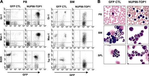 Figure 5. Immunophenotype of hematopoietic cells from NUP98-TOP1 mice. (A) Representative FACS profiles of PB (left panels) and BM (right panels) from a GFP control and diseased NUP98-TOP1 mouse. (B) Wright-Giemsa-stained PB smear, BM, and spleen cytospin (original magnification, × 600).