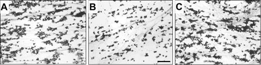 Figure 2. HuMab VN18 inhibits platelet adhesion from whole blood to a plasma-derived clot under flow. Perfusion was performed for 5 minutes at a shear rate of 500 s–1. Coverslips were processed for light microscopic evaluation (original magnification × 250) and quantified. (A) Image of platelet adhesion on a plasma clot. The surface is covered for 34% ± 7% with platelets. (B) Inhibition of platelet adhesion in the presence of huMab VN18 (16 μg/mL) to 17% ± 2% surface coverage. (C) A control huMab did not affect platelet adhesion. Bar represents 25 μm.