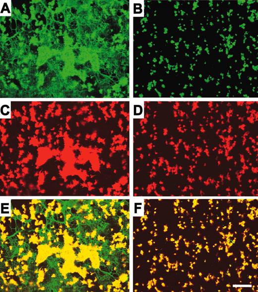 Figure 4. Isolated platelets in plasma-deficient reconstituted blood express VN on their surface after perfusion over a fibrin network. Perfusion studies were performed for 5 minutes at a shear rate of 500 s–1 with reconstituted blood containing human albumin solution instead of plasma on fibrin plus multimeric VN (A, C, E) or fibrin (B, D, F) fibers. After perfusion, coverslips were processed for confocal laser scanning microscopy (original magnification × 250): VN was visualized with an FITC-labeled Poab (green, A-B), and platelets were labeled with TRITC-phallacidin (red, C-D). The merged signal is shown in yellow (E-F). White bar represents 25 μm.