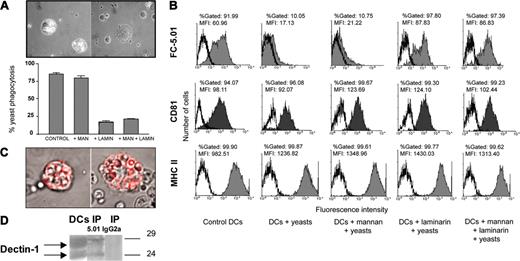 Figure 4. Internalization of cell-surface CD63 accompanies S cerevisiae yeast phagocytosis in immature DCs: association of CD63 with dectin-1. (A) A yeast phagocytosis assay was performed as described in “Materials and methods” in the presence or absence of α-mannan, laminarin, or both polyosides. The percentage of phagocytic DCs was calculated in triplicate (at least 200 cells were counted per point). The top panel shows an example of DCs bearing phagocytic vacuoles containing yeasts (left) and of DCs incubated in the presence of laminarin (right); objective lens: Plan-Neofluar 100 ×/1.3 NA, oil. The results shown are representative of at least 5 experiments. (B) CD63 surface expression was evaluated by FACS analysis after yeast phagocytosis in the presence or absence of α-mannan, laminarin, or both polyosides and in control DCs (not incubated with yeasts). Ordinate indicates number of positive cells and abscissa indicates MFI. The histograms shown are representative of at least 5 experiments. (C) Example of FC-5.01/CD63 complexes surrounding internalized yeasts as described in “Results.” Objective lens: Plan-Neofluar 100 ×/1.3 NA, oil. (D) Immunoprecipitation of CD63 was performed as described in “Materials and methods.” The immunoprecipitates were analyzed by 10% SDS-PAGE under nonreducing conditions and revealed with anti-dectin-1 polyclonal antibody followed by HRP-GAR and chemiluminescence. The antibody detected a double band of approximately 27 kDa and 23 kDa, which corresponds to the estimated molecular weight for the dectin-1 full-length and 1b isoforms.25 Lane 1: DC extract. Lane 2: CD63 immunoprecipitate (IP 5.01). Lane 3: control immunoprecipitation performed using isotype-matched control IgG2a (IP IgG2a).