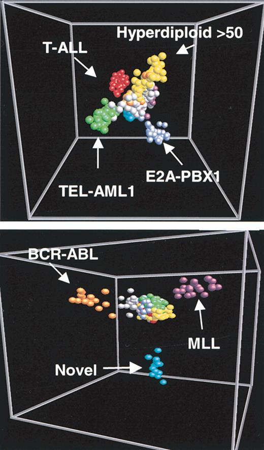 Figure 2. Multidimensional scaling plot of expression profiles from patients with ALL. Bone marrow samples from patients with ALL are each represented by a sphere. The color of the spheres corresponds to the indicated molecular abnormalities. The high dimensionality of the gene expression data has been reduced to the 3 dimensions that comprise the greatest variation across the dataset. In the top panel, the 3 component dimensions separate cases of T-ALL, E2A-PBX1, TEL-AML1, and hyperdiploid of more than 50 chromosomes from remaining ALL cases. In the bottom panel, 3 different component dimensions discriminate cases with the BCR-ABL translocation, MLL gene rearrangement, and a novel subgroup. Reprinted from Yeoh et al22 with permission.