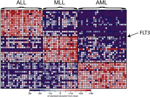 Figure 3. Gene expression profiles of bone marrow samples from patients with ALL, MLL, and AML. Each column represents a bone marrow sample and each row corresponds to a gene. The top marker genes for each diagnosis are shown. Shades of red indicate elevated expression while shades of blue indicate decreased expression. FLT3 is the gene that correlates most highly with the MLL leukemia subtype. Reprinted from Armstrong et al24 with permission.