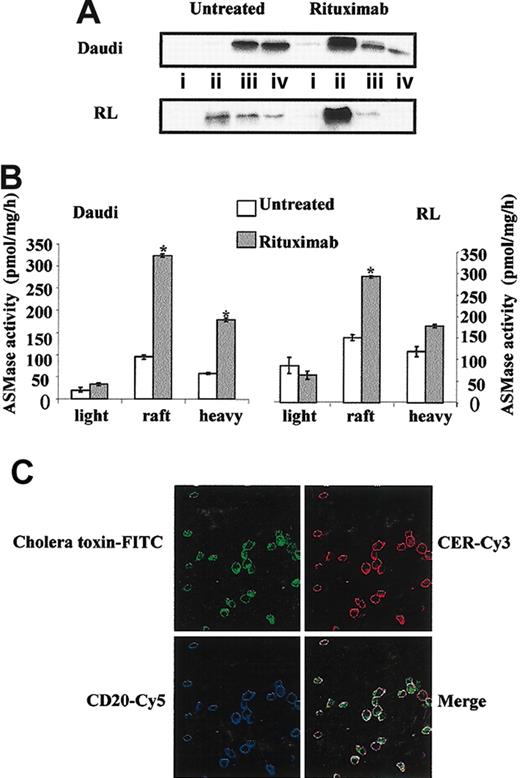 Figure 5. Rituximab induces CD20 relocalization and A-SMase activation into raft microdomains. Daudi and RL cells were treated or not for 10 minutes with 10 μg/mL rituximab, after which raft microdomains were isolated as described in “Materials and methods.” (A) CD20 localization was determined by Western blot analysis using a mouse anti-CD20 antibody. (i) Light (fractions 1-3); (ii) rafts (fractions 4-6); (iii) intermediate (fractions 7-9); and (iv) heavy (fractions 10-12). (B) A-SMase activity was measured on each fraction after raft isolation as described in “Materials and methods.” Results are the mean of 3 independent experiments ± SD. (C) Daudi cells were treated with 10 μg/mL rituximab for 15 minutes, then localization of CD20, CER, and raft microdomains was determined as described in “Materials and methods” by confocal microscopy.