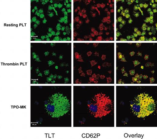 Figure 3. Localization of TLT-1 to platelet and MK α-granules. Resting (top row) or thrombin-stimulated (middle row) platelets or in vitro–derived MKs (bottom row) were permeabilized and then stained with anti–TLT-1 (left column, green) and anti-CD62P (middle column, red) followed by a combination of Alexa 488–conjugated antirabbit and Alexa 633–conjugated antigoat antibodies. The right column is an overlay of the left and middle images.