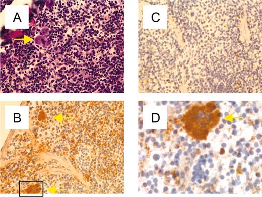 Figure 4. Expression of TLT-1 in splenic MKs and platelets. Frozen serial sections of murine spleen were fixed and stained with hematoxylin and eosin (A) or anti–TLT-1 followed by horseradish peroxidase–conjugated antirabbit antibody (B) or secondary antibody alone (C). (A-C) Magnification × 200. (D) Enlargement of the approximate area demarcated in panel B. MKs are marked by yellow arrows.