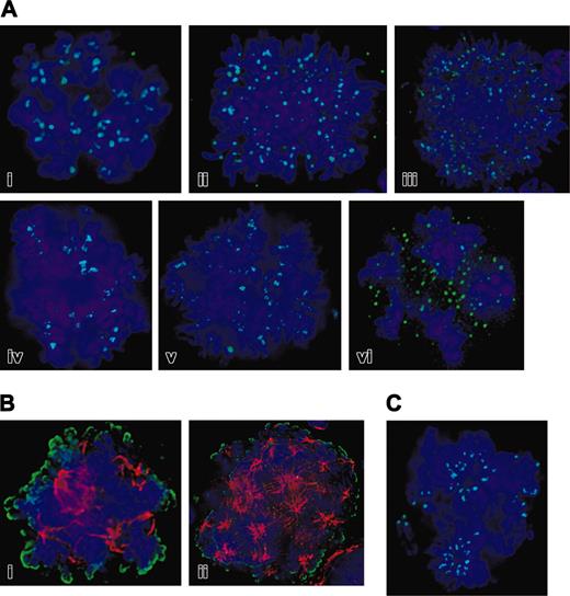 Figure 3. Functional Aurora-B kinase is expressed in EnM MKs. (A) Deconvolution images of a series of murine polyploid MKs showing localization of Aurora-B kinase (green) to centromeres. DNA is blue. Cells shown are in prometaphase with chromosomes not yet completely aligned, metaphase with chromosomal alignment evident to several plates, and anaphase. Note centromere localization of Aurora-B kinase in up through metaphase with indistinct localization in anaphase. (B) Histone H3 is phosphorylated on Ser10 in EnM murine MKs. Phospho-histone H3 is shown in green and tubulin in red; left image shows a cell with chromosomal alignment suggesting metaphase, whereas the very large cell on the right appears to be in early anaphase with chromosomal separation. (C) Localization of Aurora-B kinase (green) to centromeres does not require intact kinase activity. Purified mouse MKs were incubated for 2 hours with 5 μM ZM447439 prior to fixation and immunostaining for Aurora-B kinase (green) and phospho-histone H3 (red). Phosphorylation of histone H3 is absent due to inhibition of aurora kinase.