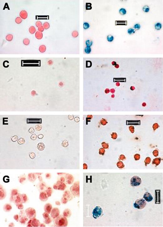 Figure 1. Representative Prussian blue-stained FE-Pro-labeled cells. (A) Unlabeled LADMACs, (B) labeled LADMACs, (C) unlabeled splenocytes, (D) labeled splenocytes, (E) unlabeled CD34+ cells, (F) labeled CD34+ cells, (G) unlabeled mesenchymal stem cells × 40, and (H) labeled mesenchymal stem cells. All labeled cells were incubated with 50:3 μg/mL of FE-Pro. Splenocytes and CD34+ cells were stained with DAB-enhanced Prussian blue. Scale bar represents 10 μm.
