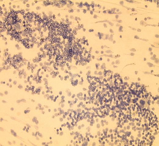 In vivo therapeutic effect of IMC-EB10 in EOL-1 xenograft and BaF3-ITD leukemia models. See the complete figure in the article beginning on page 1137.