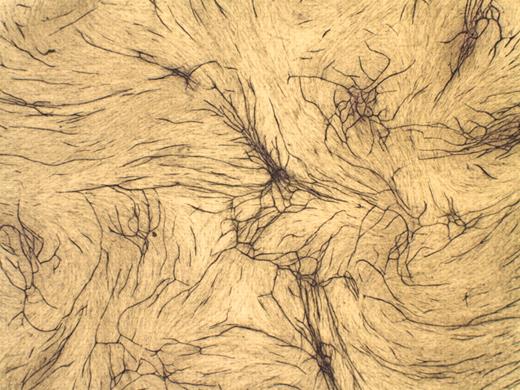 Human in vitro angiogenesis assay. See the complete figure in the article beginning on page 1159.