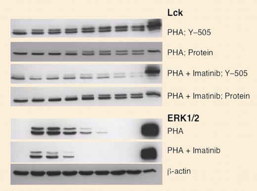 Imatinib mesylate inhibits phosphorylation of molecules participating in cellular signaling. See the complete figure in the article beginning on page 1094.
