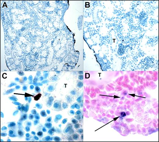 Figure 4. Immunohistochemistry of TG(zpu.1:EGFP)df5 adult kidney marrow. (A-C) Transverse sections showing EGFP-positive cells in the kidney marrow of transgenic adults at progressively increased magnification, and (D) transverse section of the kidney of transgenic fish analyzed with zebrafish pu.1 antisense RNA. T indicates renal tubule. Original magnifications × 100 (A), × 200 (B), and × 1000 (C-D). Arrows indicate positive cells.