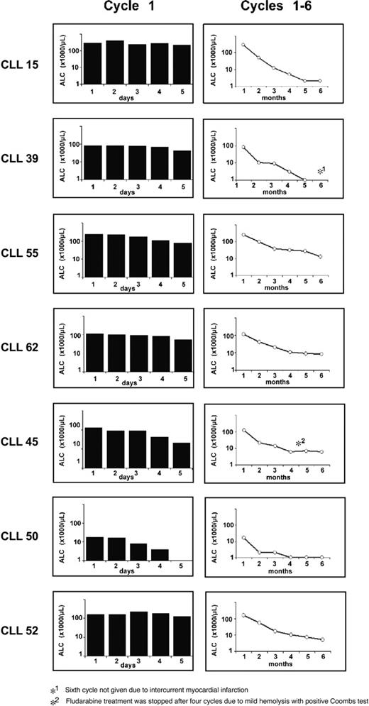 Figure 2. Clinical response to fludarabine treatment. Shown are the absolute lymphocyte counts (ALCs) for each of the 7 patients with CLL during days 1 to 5 of the first cycle of fludarabine (left column) and during the fludarabine cycles 1 to 6 (right column).