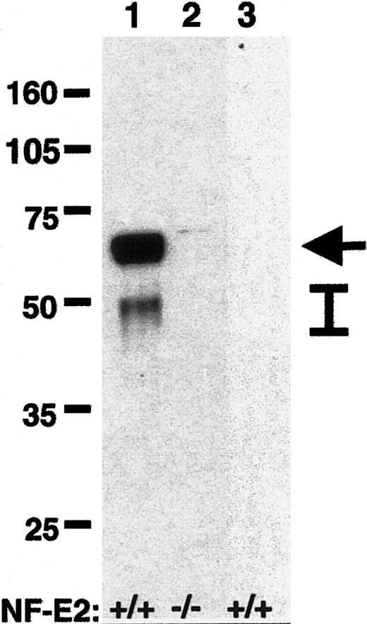Figure 1. Western blot for caspase-12 in megakaryocytes. Protein lysates (20 μg) from large polyploid NF-E2+/+ (lane 1) and NF-E2–/– (lane 2) megakaryocytes were separated by SDS-PAGE (10%), and caspase-12 was detected by Western blot after transfer of proteins to nitrocellulose membrane. Lane 3 contains protein lysate (20 μg) from CD41+, VWF+ early megakaryocyte-lineage cells from wild-type mice.27 The NF-E2 genotype is indicated below each lane, molecular weight markers (kDa) are indicated on the left, and caspase-12 (arrow) and caspase-12 cleavage products (bar) are indicated on the right.