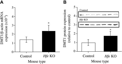 Figure 6. Expression of DMT1 mRNA and protein. (A) mRNA. (B) Protein. Messenger RNA and protein expression of DMT1 in the hepatocytes from Hfe KO (▪) and control (□) mice were quantified by real-time PCR and Western blotting, respectively, and performed as described in the “Materials and methods.” Results are expressed as mean ± SD (n = 6-8) for real-time PCR and mean ± SD (n = 7) for Western blotting. *P < .01.