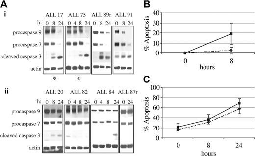 Figure 3. PARP1 cleavage correlates with apoptosis. (A) Western blot analysis showing cleavage of procaspases 3, 7, and 9 after 5 Gy IR to indicate apoptosis. Cleavage of full-length procaspases 7 and 9 and appearance of the largest cleavage product of caspase 3 are shown. Actin shows equal loading. r indicates relapse; *, delayed PARP1 cleavage. (i) Apoptosis-proficient ALL tumors showed complete cleavage of caspases 3, 7, and 9 after IR. (ii) Apoptosis-resistant ALL tumors showed absence of cleavage of caspases 3, 7, and 9 up to 24 hours after IR. (B) FACS analysis of Annexin V apoptosis assay indicating loss of plasma membrane and showing the percentage of cells undergoing IR-induced apoptosis at 0 and 8 hours after 5 Gy IR. Background apoptosis has been excluded. Data represent the average and SE from 3 apoptosis-proficient ALL tumors (ALL 92, ALL 90, and ALL 88; solid line) and 3 apoptosis-resistant ALL tumors (ALL 20, ALL 82, and ALL 85; broken line). (C) Annexin V apoptosis assay and FACS analysis showing the percentage of cells undergoing spontaneous apoptosis at 0, 8, and 24 hours. Data represent the average and SE from 3 apoptosis-proficient ALL tumors (ALL 92, ALL 90, and ALL 88; solid line) and 3 apoptosis-resistant ALL tumors (ALL 20, ALL 82, and ALL 85; broken line).