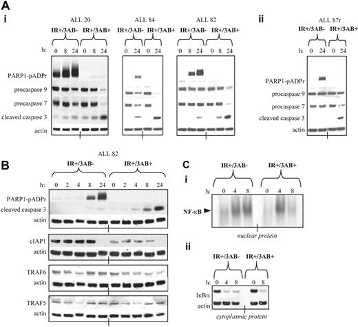 Figure 6. PARP1 inhibition using 5 mM 3-AB restored IR-induced apoptosis in apoptosis-resistant ALL tumors with increased NF-κB signaling by reducing the transcriptional activity of NF-κB. (A) Western blot analysis showing inhibition of PARP1 activity with 3-AB after 5 Gy IR. pADPr attached to the PARP1 protein (PARP1-pADPr) indicates PARP1 activity. Cleavage of procaspases 7 and 9 and the appearance of the largest cleavage product of caspase 3 was measured before and after IR and PARP1 inhibition. Actin shows equal loading. (i) Treatment with 3-AB and IR initiated procaspase cleavage in 3 apoptosis-resistant ALL tumors with abnormal NF-κB signaling. (ii) Treatment with 3-AB and IR failed to initiate procaspase cleavage in an apoptosis-resistant ALL tumor with defective p53 activation. (B) Adding 3-AB reduced the expression of the NF-κB–responsive protein cIAP1 and of TRAF6 but not of TRAF5, and it induced caspase 3 cleavage after 5 Gy IR in an apoptosis-resistant leukemia (ALL 82). Actin serves as a loading control. (C) EMSA showing the effect of 3-AB on NF-κB activation and binding to a 29-bp HIV-κB oligonucleotide (see “Materials and methods”) after 5 Gy IR. (i) Adding 3-AB abrogated NF-κB DNA binding 8 hours after IR in the nuclear protein. (ii) Adding 3-AB had no effect on the degradation of the NF-κB inhibitory protein IκBα in the cytoplasmic protein.