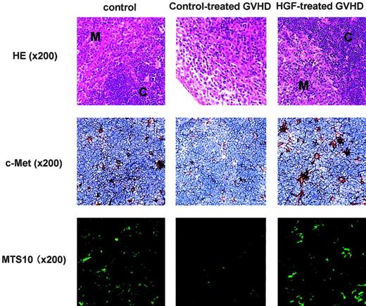 Figure 5. TEC expression of c-Met and the effect of HGF treatment. The HGF receptor c-Met is expressed by TECs and HGF treatment reduces TEC injury. Top row: BDF1 (Ly5.2) recipients were treated as described in the Figure 4 legend. On day 14 after GVHD induction, thymic tissue sections from the 3 groups that received transplants were analyzed for histology with the use of hematoxylin and eosin (HE) stain. M indicates medulla; and C, cortex. Middle row: On day 14 after GVHD induction, thymic tissue sections from the 3 groups that received transplants were analyzed for the expression of HGF receptor c-Met with the use of an anti–c-Met antibody. Adjacent sections (not shown) were stained for cytokeratin to verify the presence of TECs. Bottom row: On day 14 after GVHD induction, thymic tissue sections from the 3 groups that received transplants were analyzed for medullary TECs with the use of an anti-MTS10 antibody. Original magnification × 200 (indicated in parentheses). Image acquired using a dual-model cooled CCD camera C4880 (Hamamatsu Photonics, Hamamatsu, Japan), numerical aperture 0.75, and ARGUS (Hamamatsu Photonics).