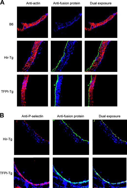 Figure 2. Immunohistology of mouse aortas using antifusion protein mAb (antihirudin for Hir-Tg and antihuman TFPI for TFPI-Tg). All sections stained with DAPI (4,6 diamidino-2-phenylindole) nuclear stain (blue). (A) Expression of the fusion proteins is restricted to the intima. Antifusion protein mAb (green) contrasting with anti–α-actin mAb (red) used to stain media (original magnification × 100). (B) Colocalization of fusion proteins (green) with P-selectin (red) in ECs of the transgenic mice (original magnification × 100).