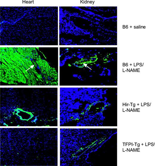 Figure 4. Immunohistology of heart and kidney from saline- or LPS/l-NAME–treated control and Tg mice. All sections were stained with an antifibrinogen antibody that also detects fibrin (green) and with the nuclear stain DAPI (blue) (original magnification × 100). White arrows indicate vessels with intraluminal clot. No staining was detected in organs from saline-treated Hir-Tg or TFPI-Tg mice (data not shown).