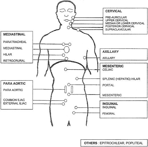 Figure 1. Mannikin used for counting the number of involved areas. See “Demographic characteristics and initial staging” in the text. Each rectangle corresponds to a nodal area.