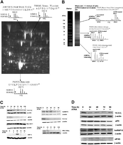 Figure 3. Validation of proteomic results. (A) A 2-DE image of the β-actin region for NB4 cultured in a 99% isotopic abundance of Leu-d3. The plots represent tryptic peptides of β-actin, heat shock protein 70, and stress-70 protein, which contain 1 leucine amino acid. The peaks of 896.0, 682.9, and 897.5 are the monoisotopic peaks for the peptides yielding the Leu-d3 amino acid, and in each plot the asterisk represents the nondeuterated form of the peptide. (B) SDS-PAGE separation of a 1:1 mixture of nontreated versus ATRA-treated NB4 at 24 hours. The ATRA-treated cells were grown in a 99% isotopic abundance of Leu-d3 media and mixed 1:1 with nontreated cells grown in normal culture media in accordance with the AACT methodology. The plots on the right represent the AACT-based quantification of tryptic peptides obtained from in-gel digests. Relative intensity comparisons of the same leucine containing peptides from nontreated and ATRA-treated NB4 yield the up-regulation of myosin heavy chain (650.7 versus 655.7), unchanged β-actin (895.9 versus 897.4), and down-regulated cofilin (669.3 versus 670.8). (C) Western blot analysis of 14-3-3ϵ, 14-3-3ζ, hnRNP K, eIF4G, Rho GDI-1, DAP5/p97/NAT1, and PML-RARα as a function of ATRA treatment, using 50 μg total protein. Antibodies to 14-3-3ϵ, 14-3-3ζ, hnRNP K, eIF4G, Rho GDI-1, DAP5/p97/NAT1, and PML-RARα were used to detect expression of specific proteins. (D) HL-60 Western blot analysis of 14-3-3ζ, hnRNP K, eIF4G, and eIF5 as a function of ATRA treatment, using 50 μg total HL-60 protein.