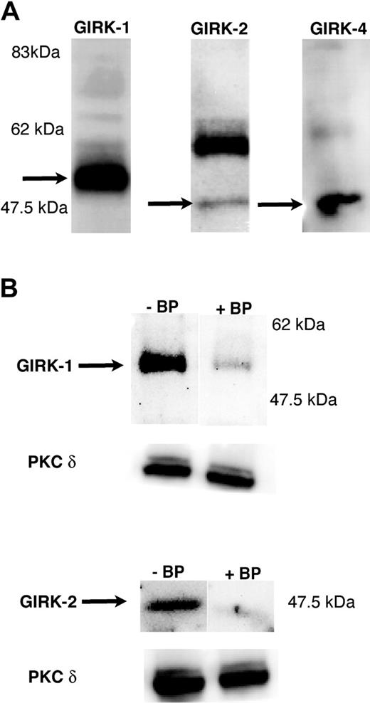 Figure 1. Detection of GIRK subunits in platelets by Western blotting. Washed and aspirin-treated human platelets were lysed with (3×) sample buffer, and 10 μLof protein lysate was loaded onto a 10% Tris-glycine gel. Western blotting was performed using specific antibodies against GIRK1, GIRK2, and GIRK4 (A) and in the presence of blocking peptides as described in “Materials and methods” (B). The molecular weights are indicated in each of the blots. The predominant GIRK1 band was noticed at approximately 55 kDa. GIRK2 and GIRK4 both were detected at 47.5 kDa molecular weight range. The blot was probed with antibodies against PKC-δ to ensure equal loading of lanes with protein.