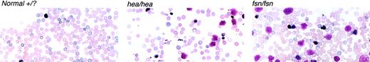 Figure 2. Peripheral blood smears from 7-day-old hea and fsn mice show several disturbances in red cell morphology. Marked anisocytosis, polychromasia, poikilocytosis, nucleated red cells, naked nuclei, and smudge cells are observed in hea and fsn pup blood smears as compared with a normal pup littermate. Micrographs were prepared using an Olympus VANOXT AH2 Version microscope and an Olympus camera (both from Olympus, Melville, NY). High dry objective lenses with a numerical aperture of 1.25 and an objective of 60× at a magnification of 600× were used. The images were scanned and labeled with Adobe Photoshop software.