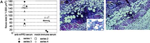 Figure 4. Exacerbation of a TNF-α–induced panniculitis by mPR3-ANCAs. Mice treated intravenously with either autologous mPR3-ANCA serum (antiserum pool 1) or serum from mock-immunized mice received TNF-α locally in the same skin area on 4 consecutive days. The contralateral side was treated either with PBS or PBS/0.1% BSA (TNF-α solvent) as a control. (A) The degree of cellular infiltrations in the subcutaneous adipose tissue was measured with digital image analysis software. The plotted data show the net focus size increase between TNF-α–treated and control-treated skin in 17 mice belonging to 4 independent experimental series, which are distinguished by squares, circles, triangles, and diamonds. Nine mice were treated with autologous mPR3-ANCA serum (left column), and 8 mice received serum from mock-immunized mice (right column). Horizontal lines indicate the median of the 2 experimental groups. The difference between mPR3-ANCA serum and mock immune serum–treated animals is statistically significant (P = .043, Mann-Whitney U test). (B) Histologic sections of biopsies from an mPR3-ANCA serum-treated mouse (i) and a mock immune serum-treated mouse (ii) are shown (original magnification × 200; inset × 400). Note the dense cellular infiltrate in the subcutaneous adipose tissue that is accompanied by an apparent local increase of the septal volume. The cellular infiltrate consisted of neutrophils, eosinophils without leukocytoclasia, and mononuclear cells. Staining with an antibody against the neutrophil marker Ly-6G confirms the presence of neutrophils in the inflammatory infiltrate (red-stained cells in the inset). Images were acquired using the same equipment described in the Figure 2B legend.