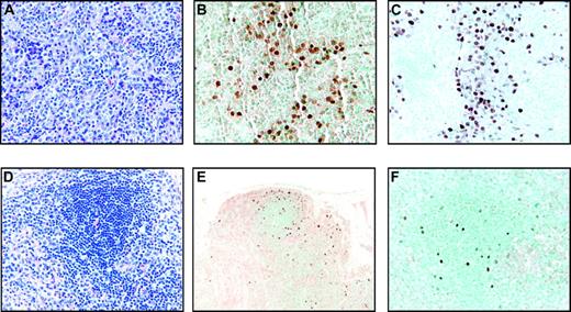 Figure 4. Tissue invasion of rhesus LCV-positive cells in Mm321-98. (A) Hematoxylin and eosin–stained section of a lymph node biopsy performed on day 36 after intravenous inoculation of autologous rhesus LCV-immortalized B cells. Original magnification × 100. (B) EBERs in situ hybridization (original magnification × 200) and (C) EBNA-2 immunohistochemistry on sections of the same lymph node biopsy (original magnification × 200). (D) Hematoxylin and eosin–stained section from the spleen obtained at necropsy on day 57 (original magnification × 100). (E) EBERs in situ hybridization (original magnification × 20) and (F) EBNA-2 immunohistochemistry on sections from the spleen (original magnification × 100).
