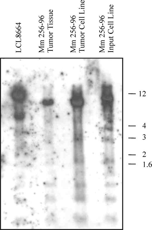 Figure 6. Southern blot analysis for viral clonality. Genomic DNA from the rhesus LCV-producing B-cell line LCL8664, Mm256-96 tumor tissue, a cell line derived from the Mm256-96 tumor tissue, and the autologous, rhesus LCV–infected cell line used for intravenous inoculation were separated on a 0.6% agarose gel, transferred to a nylon membrane, and hybridized with a rhesus LCV DNA probe for the terminal repeats. Molecular weight markers in kilobases are shown to the right.