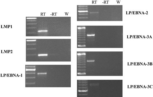 Figure 7. RT-PCR analysis for rhesus LCV latent infection gene expression in Mm256-96 tumor tissue. RT-PCR was performed on RNA extracted from the Mm256-96 tumor tissue with the use of primers specific for the mRNAs of rhesus LCV latent membrane protein 1 (LMP1), latent membrane protein 2A (LMP2A), and mRNAs spliced from the terminal exon of EBNA-LP to the coding region for EBNA-1,-2, -3A, -3B, and -3C. Control reactions consisting of all reagents except reverse transcriptase (-RT) or with water in place of RNA (W) are included. Molecular weight markers are shown in the leftmost column, with the brightest band representing 500 bp and minor bands at increments of 100 bp.