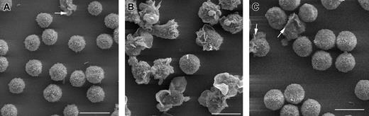 Figure 1. Low-magnification SEM of cells from human blood. (A) Lymphocytes. Arrow indicates cell with surface ruffles. (B) Monocytes. Cell 1 displays no ruffles but has microvilli. Cell 2 displays ruffles on one half and microvilli on the other. (C) PMNs. Arrows indicate cells with large ruffles. Scale bars are 10 μm.