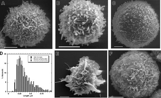Figure 2. Surface morphologies of white blood cells. SEMs of a human blood lymphocyte (A), mouse blood lymphocyte (B), 300.19 murine pre-B lymphoma cell (C), human blood monocyte (E), and human blood PMN (F). Scale bars represent 2 μm. (D) Histogram of microvillar lengths for 300.19 cells (▪), mouse blood lymphocytes (▧), and human blood lymphocytes (▦). Bins are 0.05 μm. Numeric data are in Table 1.