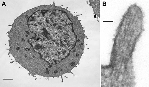 Figure 3. Lymphoma cell microvilli contain parallel actin filaments. Transmission electron micrographs of a 300.19 cell (A) and of an individual 300.19 cell microvillus (B). Note parallel striations in microvillus, which have diameters similar to those of actin filaments. Scale bars represent 1 μm (A) and 50 nm (B).