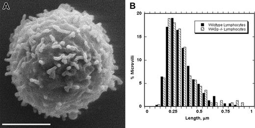 Figure 5. Lymphocytes from WASp knock-out mice have normal microvilli. (A) SEM of representative blood lymphocyte from WASp knock-out mouse. Scale bar represents 2 μm. (B) Histogram comparing microvillar lengths for wild-type and WASp knock-out mouse lymphocytes. Bins are 0.05 μm. Numeric data are in Table 2.